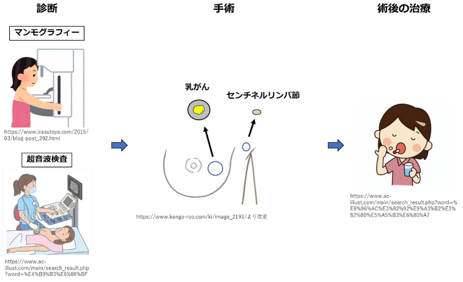 乳がんの診断と治療の流れ