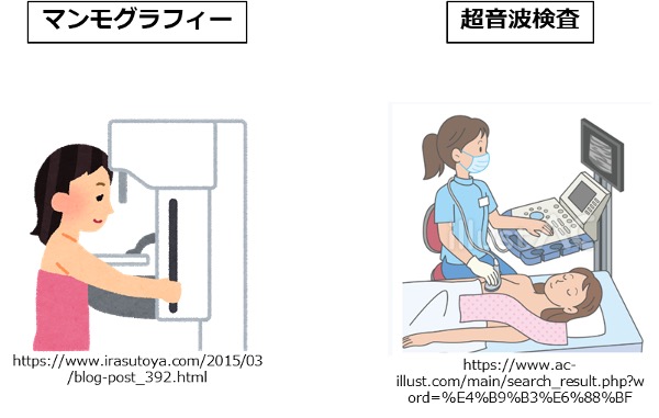 マンモグラフィー検査と超音波検査
