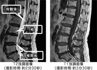 T2強調画像（撮影時間：約2分30秒）,T1強調画像（撮影時間：約3分30秒）